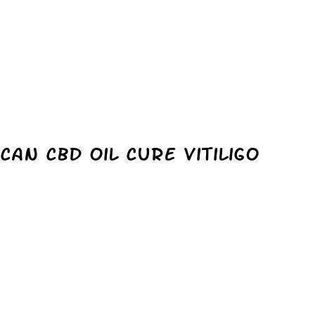can cbd oil cure vitiligo