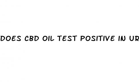 does cbd oil test positive in urine