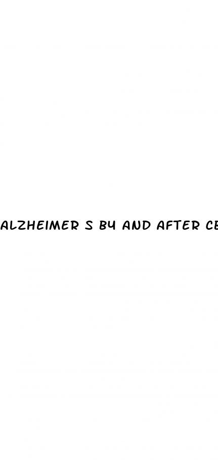 alzheimer s b4 and after cbd oil