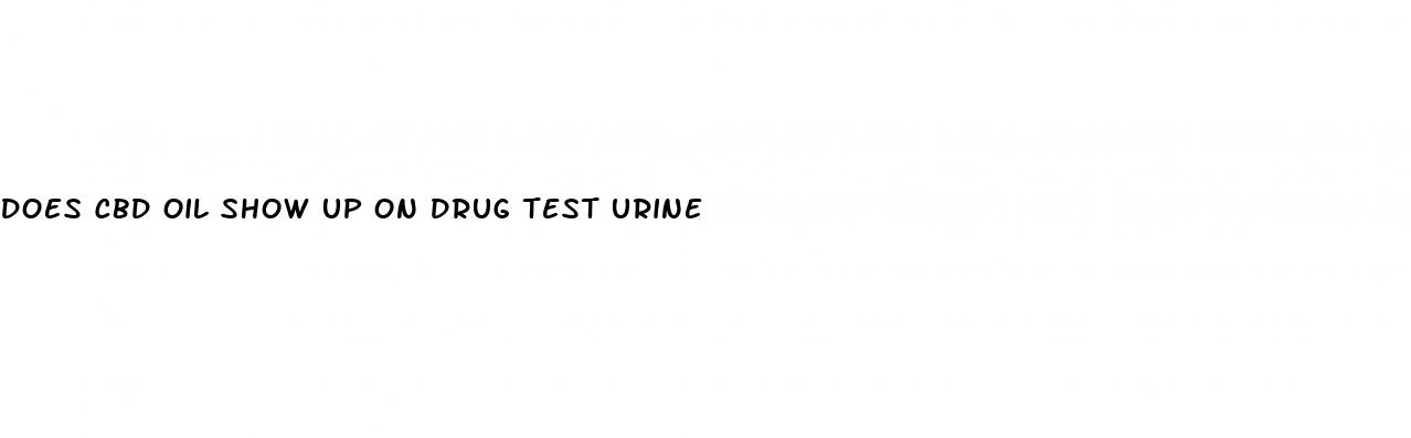 does cbd oil show up on drug test urine