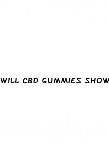 will cbd gummies show up on a dot drug test