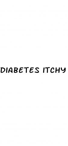 diabetes itchy feet