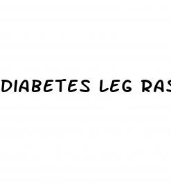 diabetes leg rash