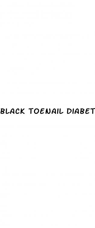 black toenail diabetes