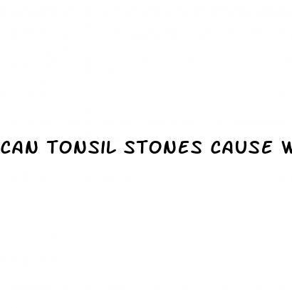 can tonsil stones cause weight loss