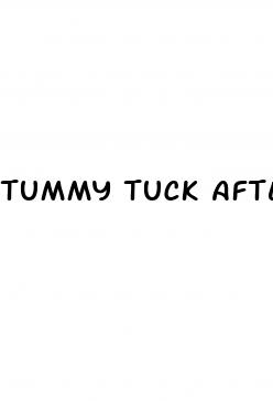 tummy tuck after weight loss surgery