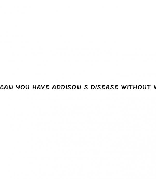 can you have addison s disease without weight loss