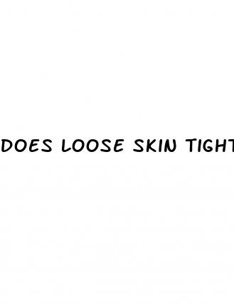 does loose skin tighten up after weight loss