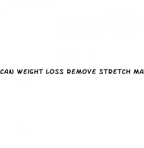 can weight loss remove stretch marks