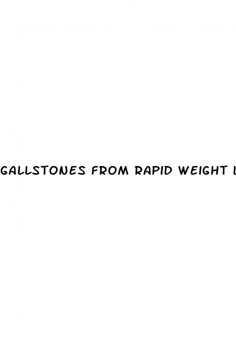 gallstones from rapid weight loss