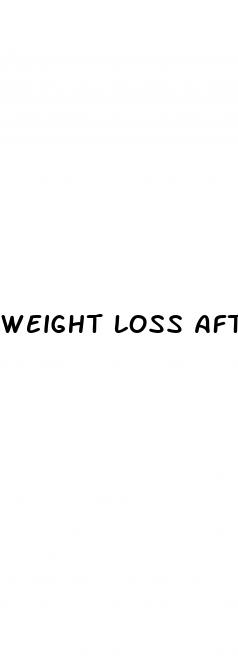 weight loss after stopping zoloft