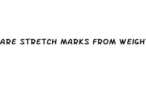 are stretch marks from weight gain or loss