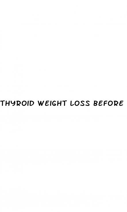 thyroid weight loss before and after