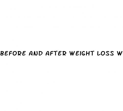 before and after weight loss women