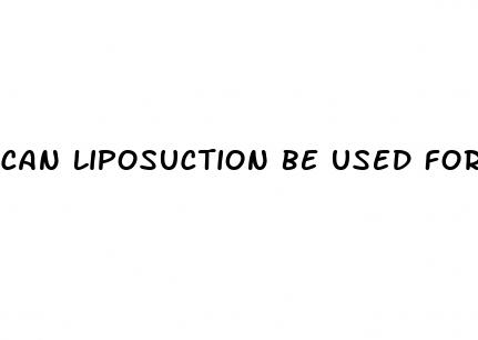 can liposuction be used for weight loss