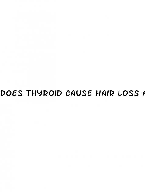 does thyroid cause hair loss and weight gain