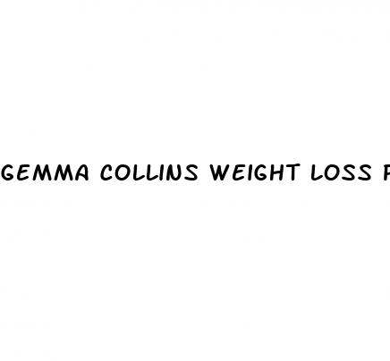 gemma collins weight loss pills