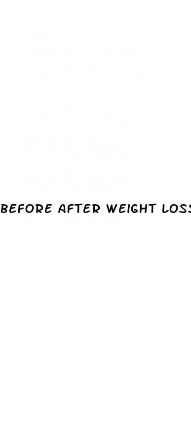 before after weight loss pictures