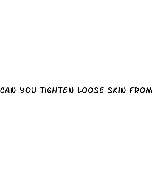 can you tighten loose skin from weight loss