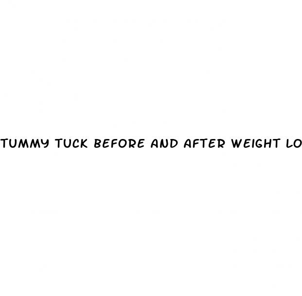 tummy tuck before and after weight loss