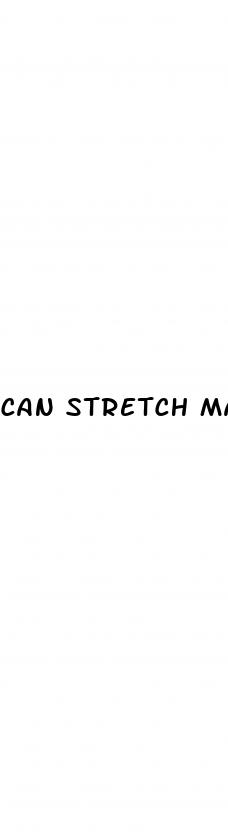 can stretch marks mean weight loss
