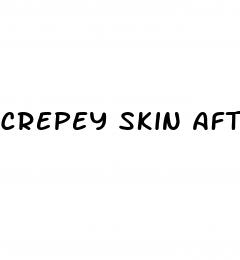 crepey skin after weight loss
