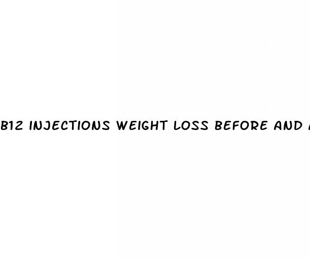 b12 injections weight loss before and after