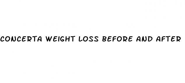 concerta weight loss before and after