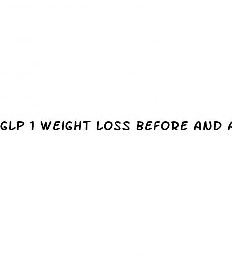 glp 1 weight loss before and after
