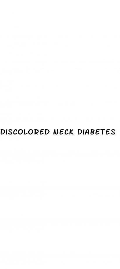 discolored neck diabetes