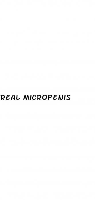 real micropenis