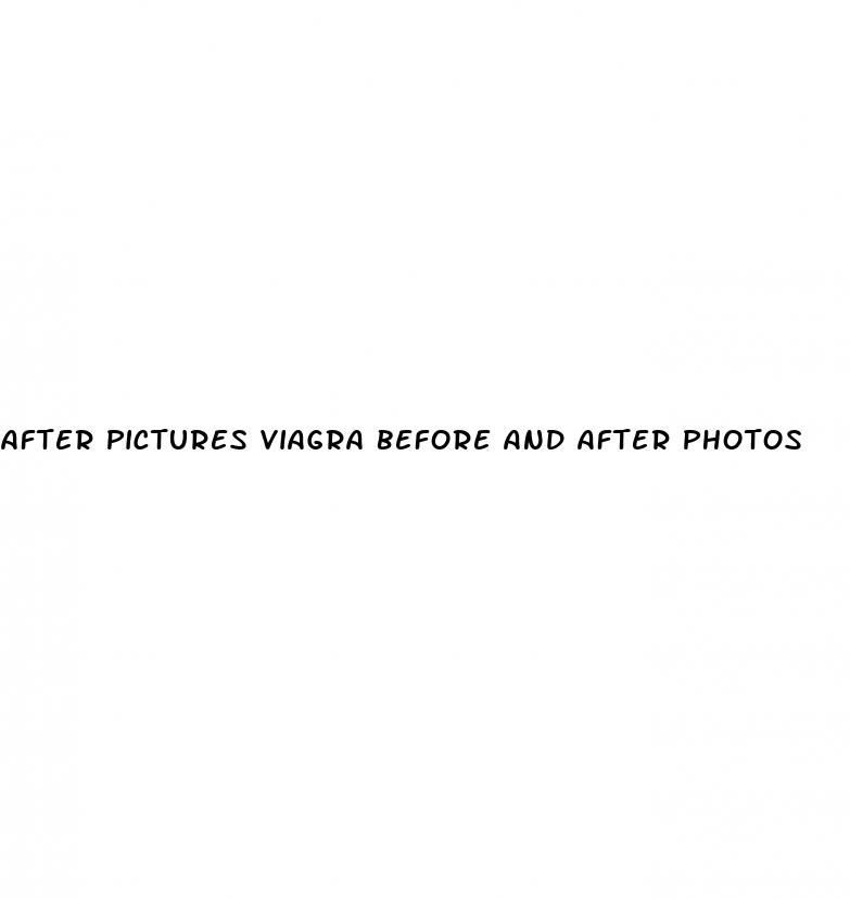 after pictures viagra before and after photos