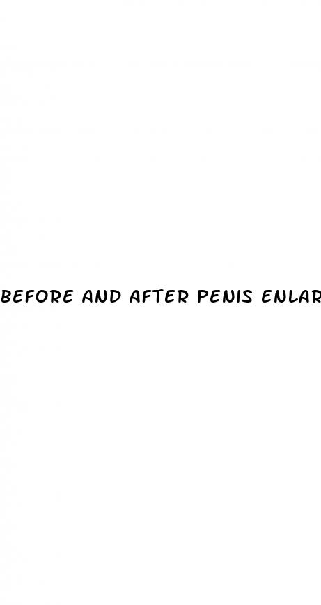 before and after penis enlargment