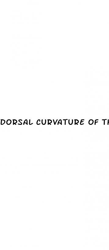 dorsal curvature of the erect penis