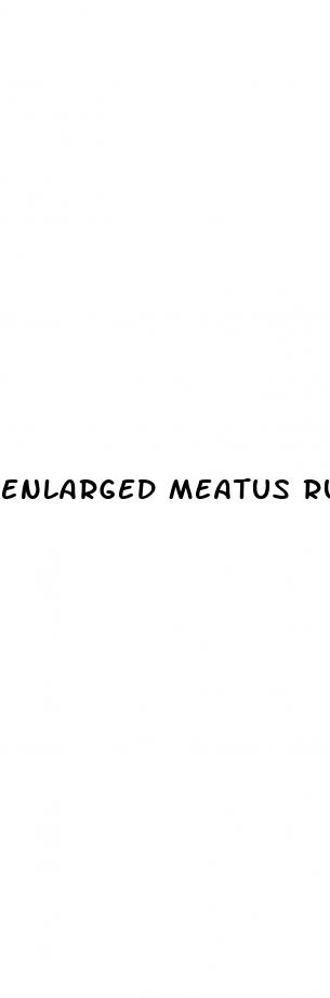 enlarged meatus rubbing penis