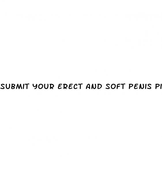 submit your erect and soft penis pics