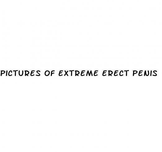 pictures of extreme erect penis