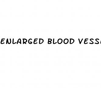 enlarged blood vessel on penis