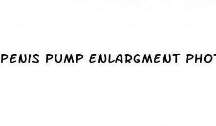 penis pump enlargment photos
