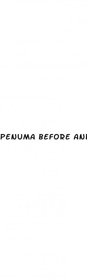 penuma before and after reviews