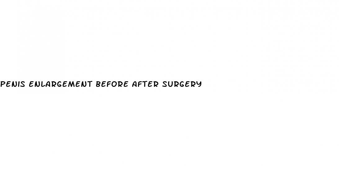 penis enlargement before after surgery