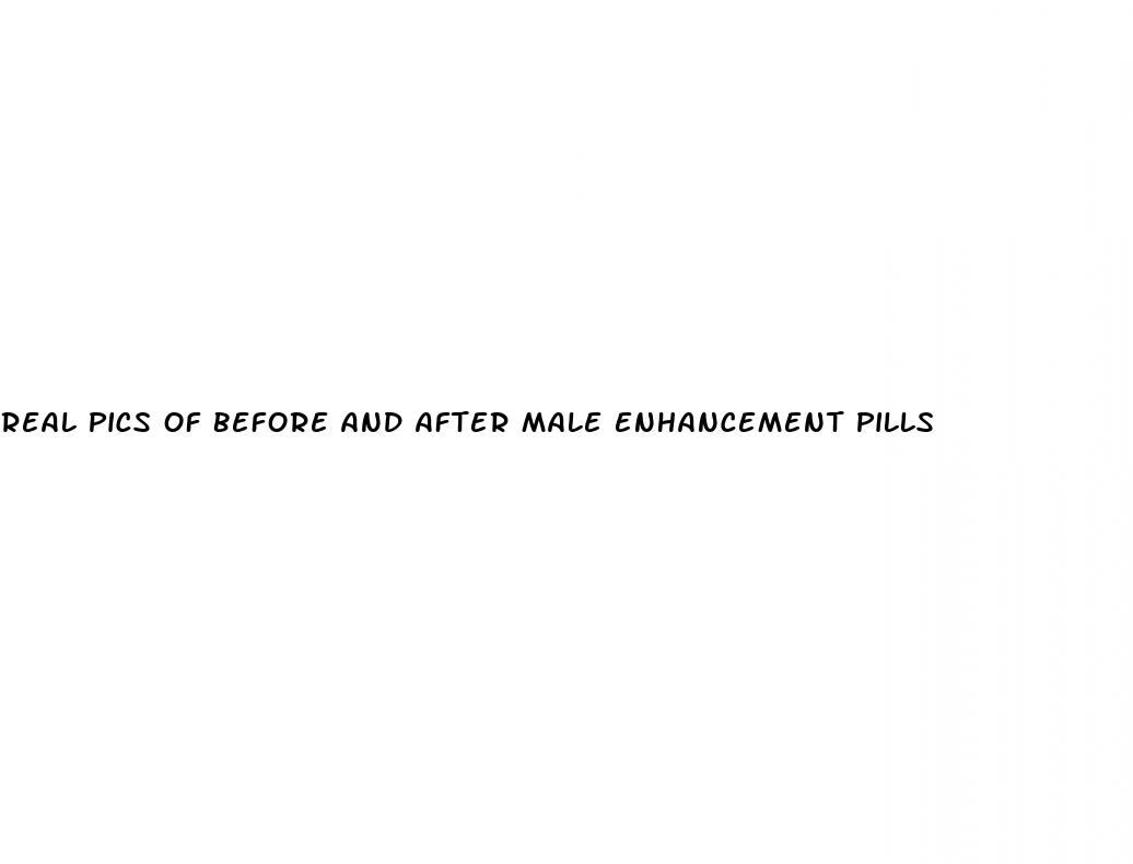 real pics of before and after male enhancement pills