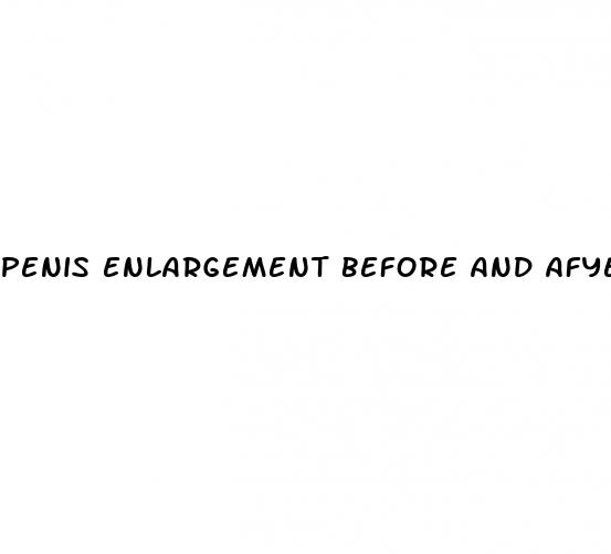 penis enlargement before and afyer