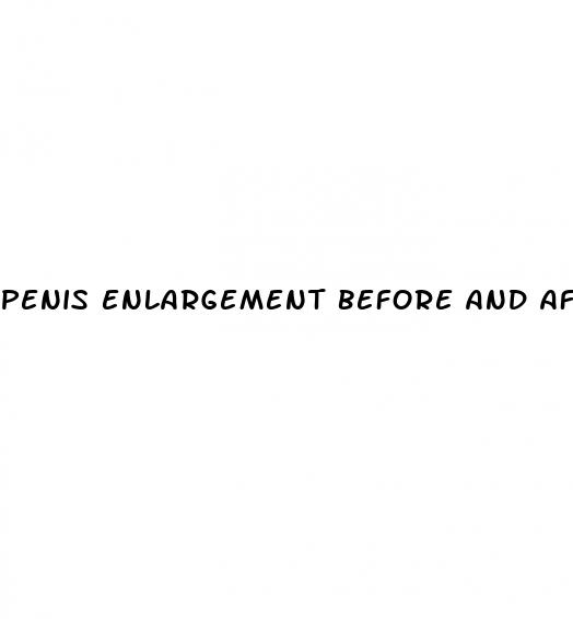 penis enlargement before and aftet