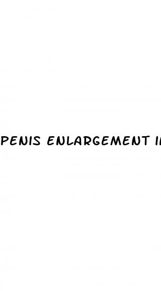 penis enlargement in durban