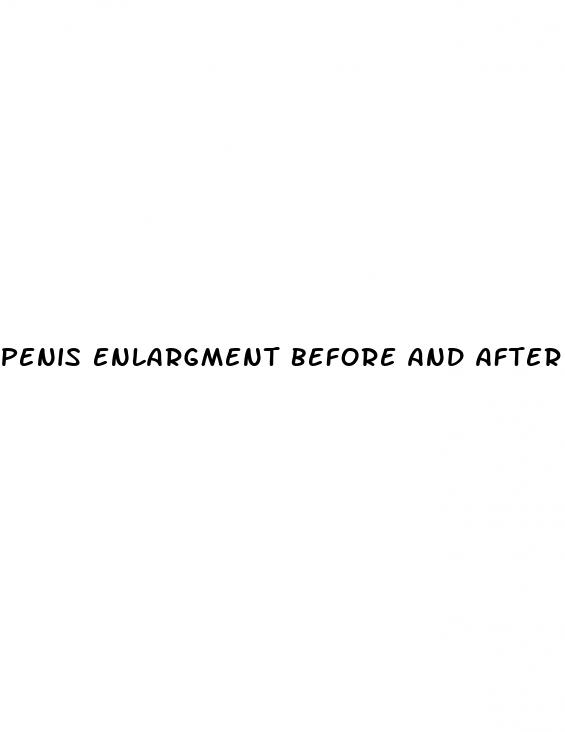 penis enlargment before and after pics
