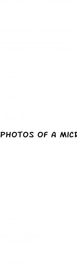 photos of a micropenis
