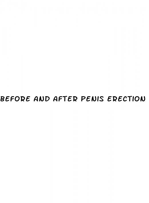 before and after penis erection surgery