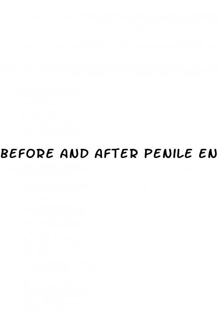 before and after penile enlargement