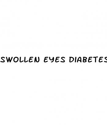 swollen eyes diabetes